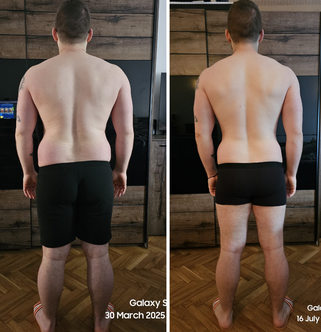 Antonio transformacija